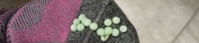 袜子上面有白色液体,卫生隐患与防护措施”
